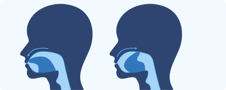 Train Your Mouth to Stop Snoring